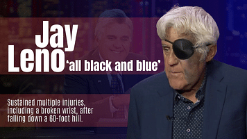 Jay Leno Gets Back On His Feet After Latest Accident: 'The Pain Is Nothing'